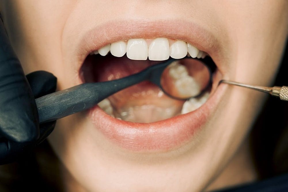 Wizyta kontrolna w gabinecie stomatologicznym: jak wygląda i ile trwa